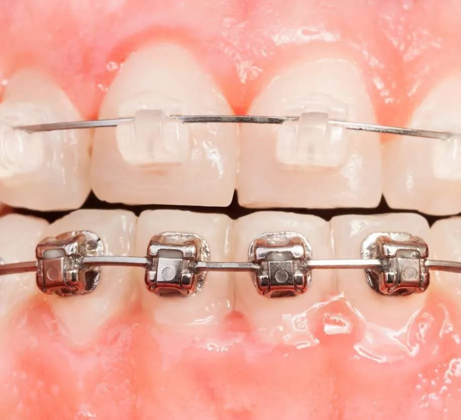 Orthodontics