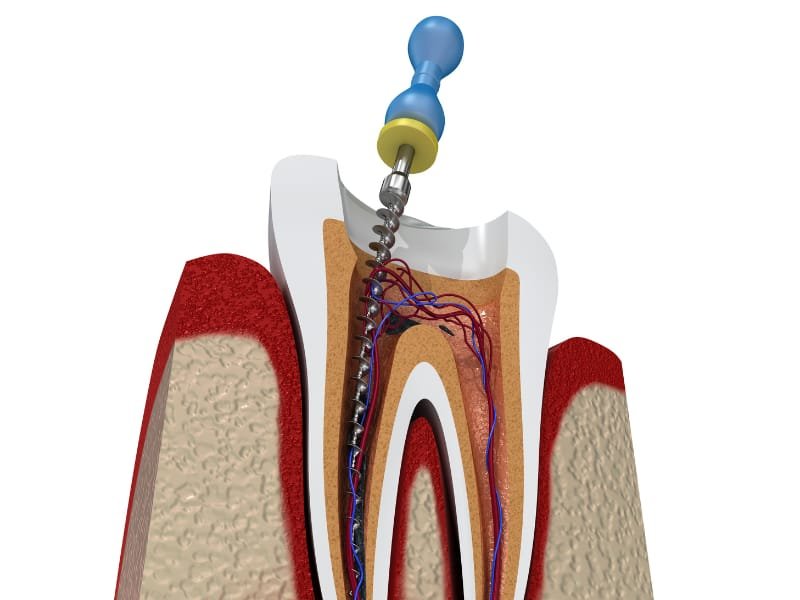 Endodontics