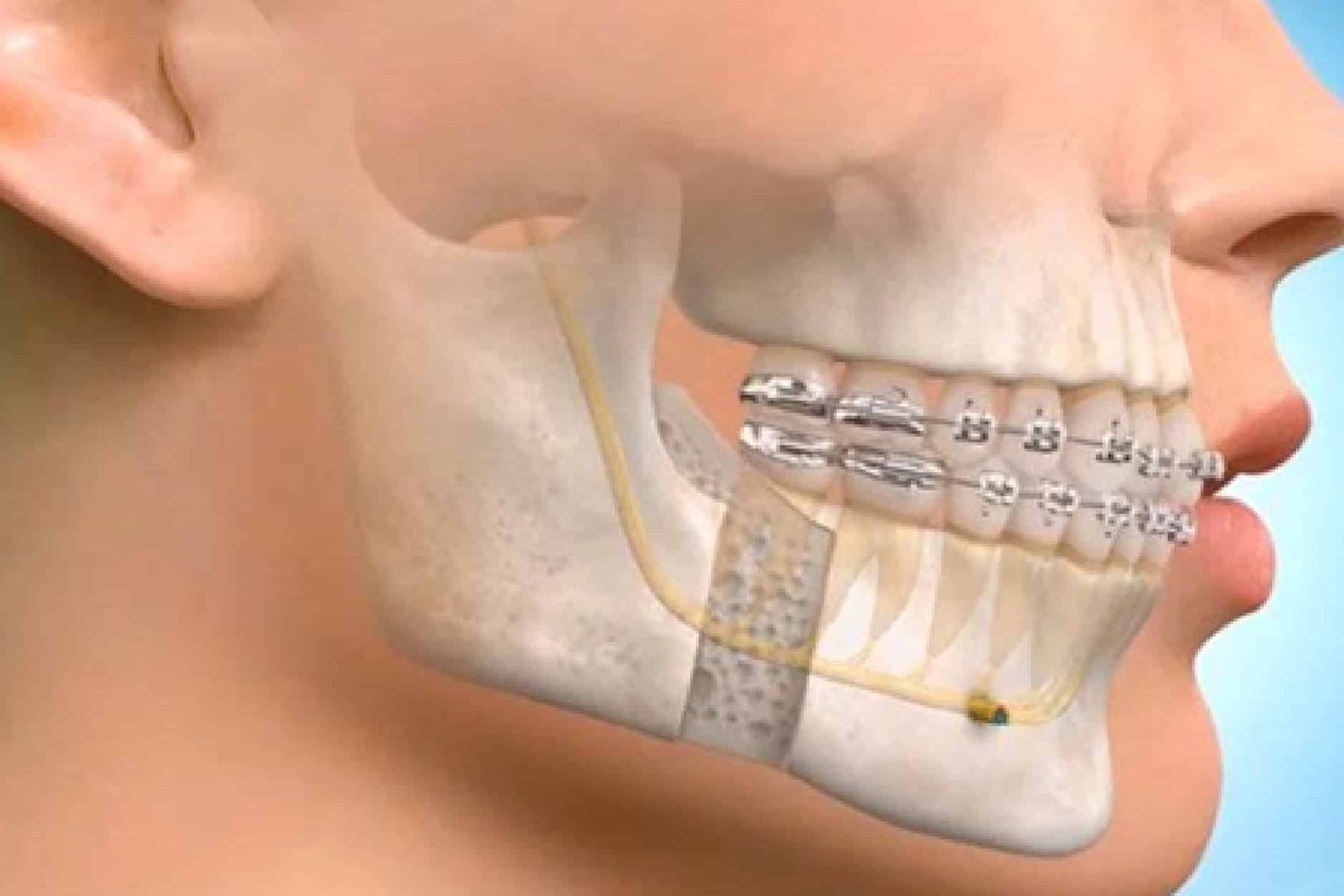 Oral and Maxillofacial Surgery