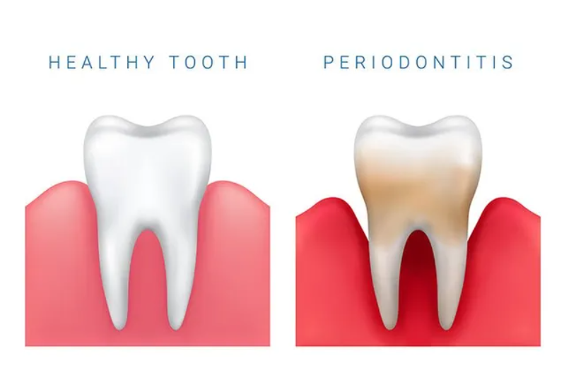 Periodontics